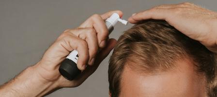 Cuándo y cómo utilizar una loción contra la caída del cabello