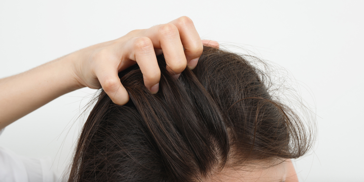 Suffering from psoriasis on your scalp? Discover the causes and solutions