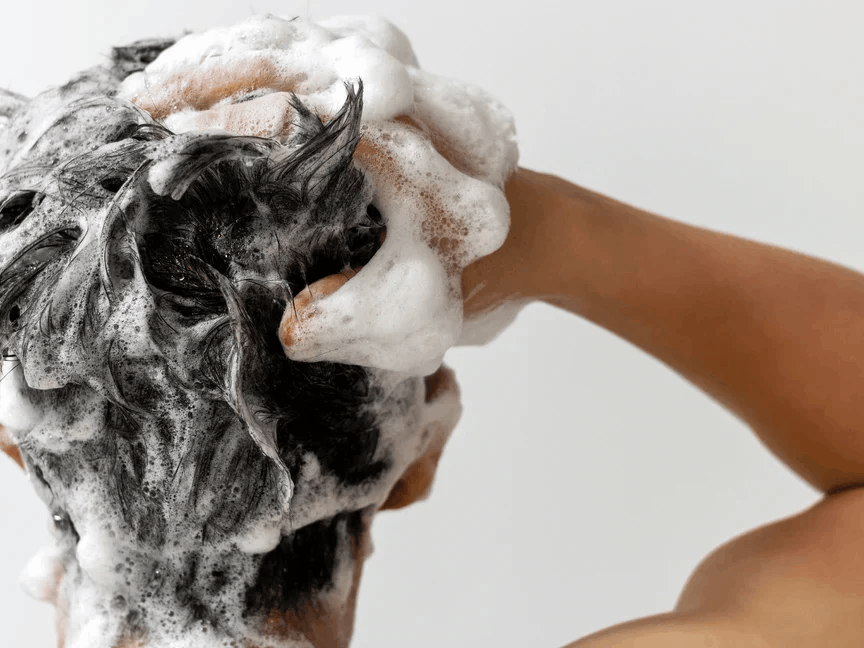 Minoxidil in schiuma vs. lozione - Due rimedi per la caduta dei capelli a confronto