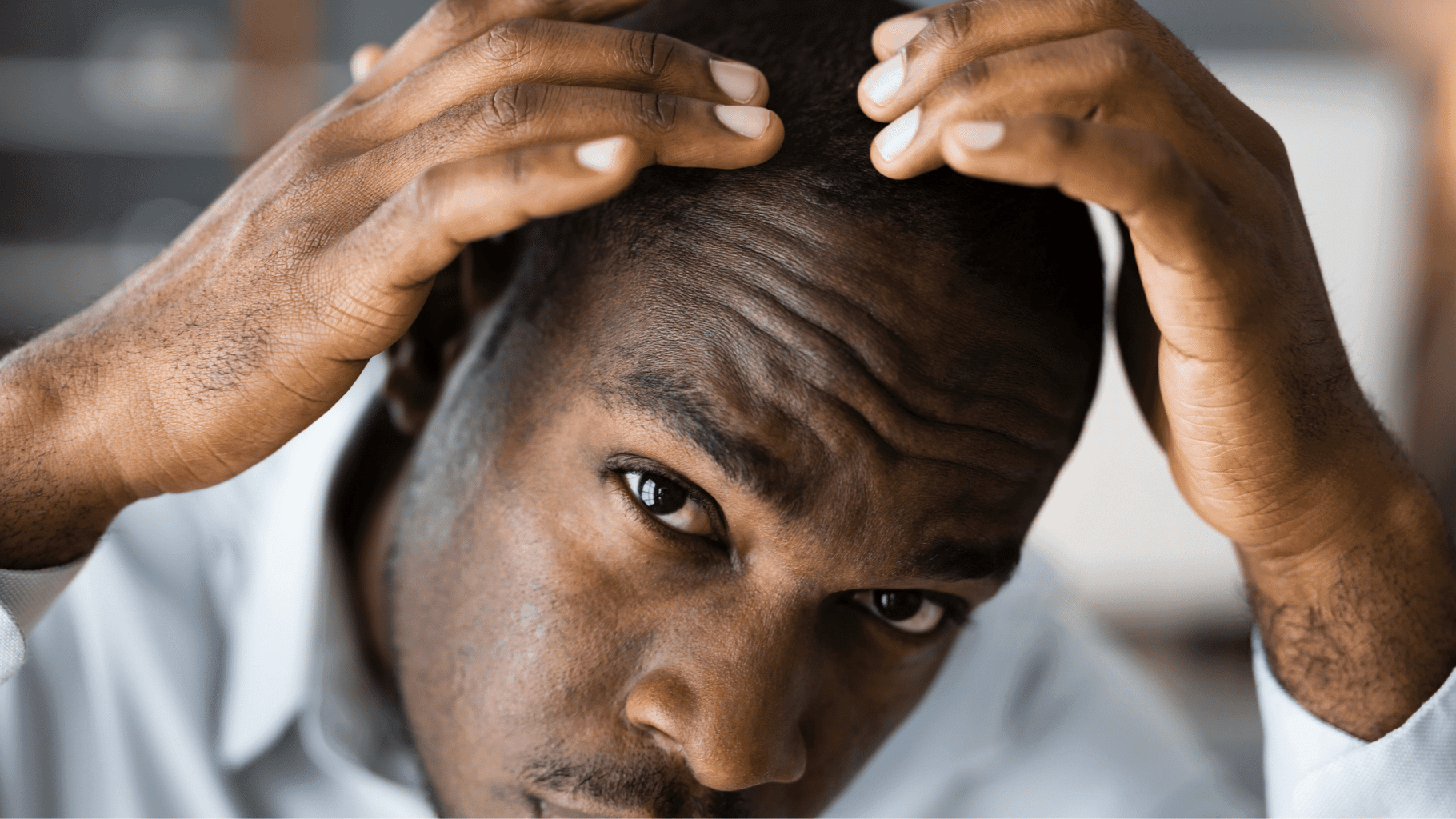 The effect of Ketoconazole and Piroctone olamine on hair growth