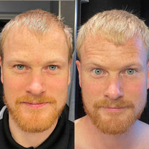 Scandinavian Biolabs hair growth treatment (men)