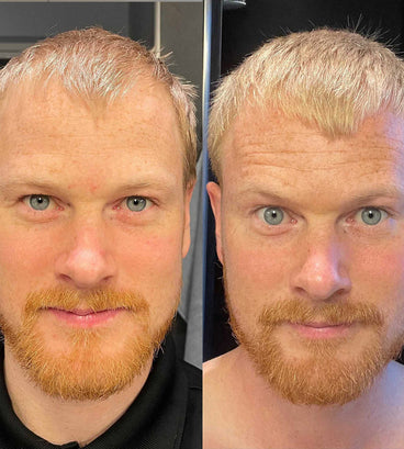 Scandinavian Biolabs hair growth treatment (men)