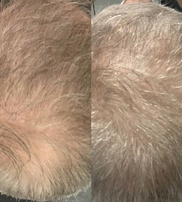 Scandinavian Biolabs hair growth treatment (men)