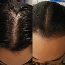 Scandinavian Biolabs hair growth treatment (women)