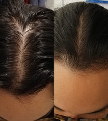 Scandinavian Biolabs hair growth treatment (women)