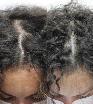 Scandinavian Biolabs hair growth treatment (women)